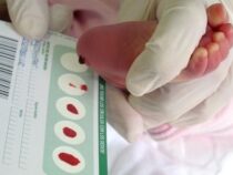 По программе расширенного неонатального скрининга в роддоме Алапаесвкой больницы на 36 генетических заболеваний с начала года обследовано 129 родившихся деток