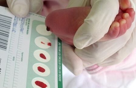 По программе расширенного неонатального скрининга в роддоме Алапаесвкой больницы на 36 генетических заболеваний с начала года обследовано 129 родившихся деток